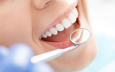 予防歯科・クリーニング